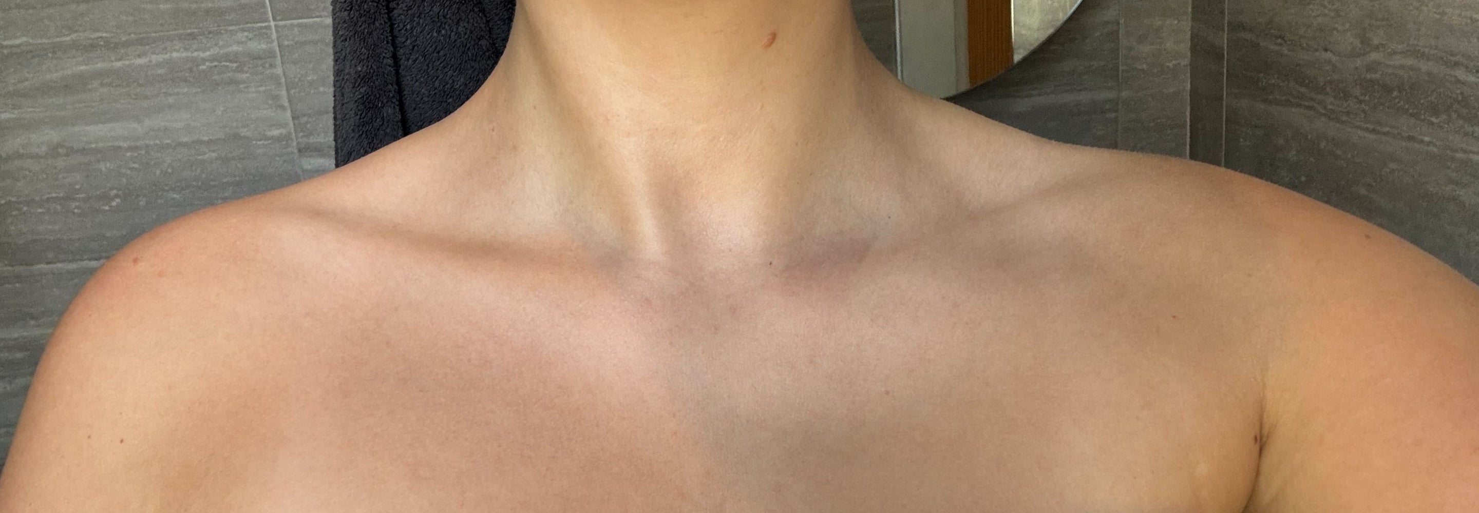 Partial view of a person's neck and shoulders all clear from irritation due to natural products not aggravating the skin with a neutral background