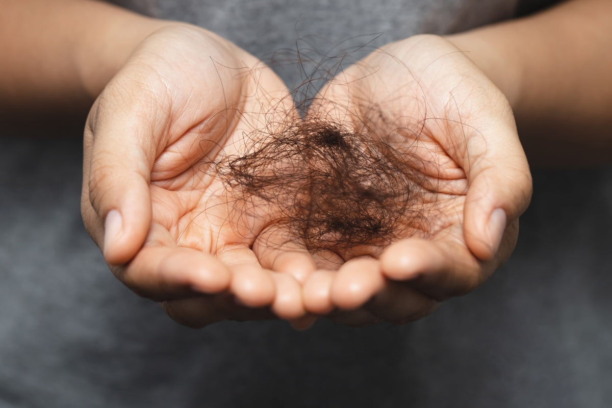 Why is My Hair Shedding?