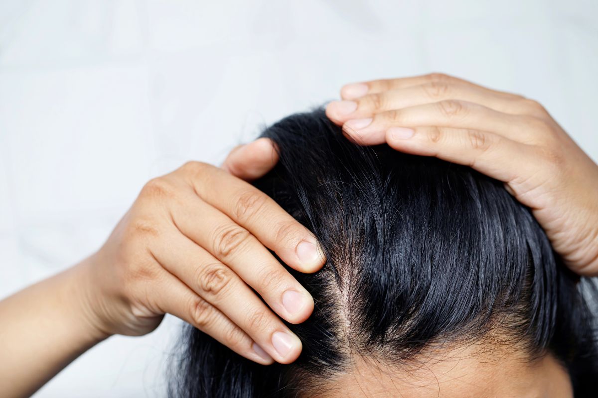 Why Is My Scalp Itchy? Expert Advice on the Most Common Causes of an Irritated Scalp and How to Soothe It